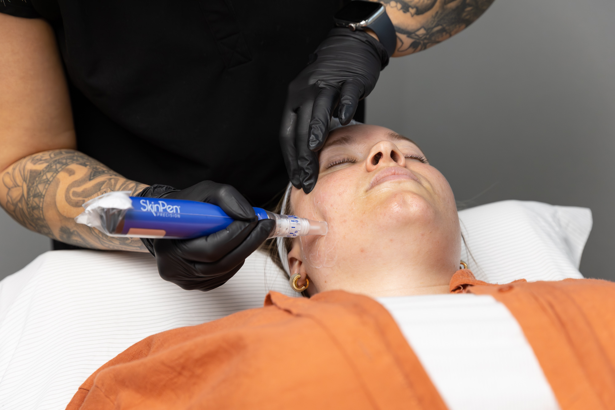 A female patients reclines on a treatment table with her eyes closed. A Spry provider, wearing black surgical gloves, applies the SkinPen wand to her cheek to maximize the positive results from microneedling in Waterloo.