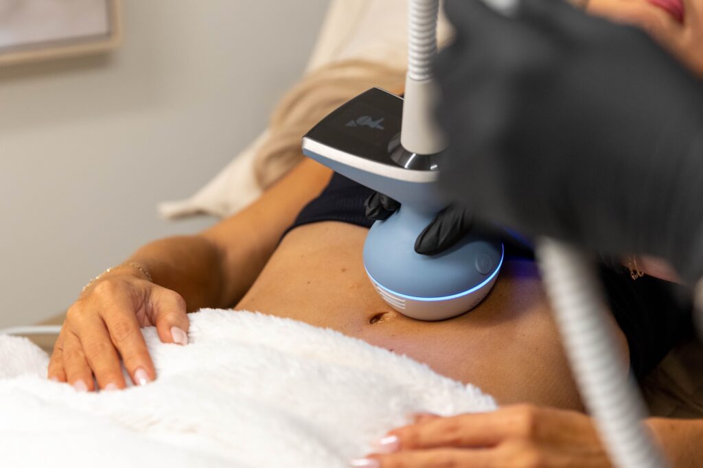 Photo of Exion device on patient's abdomen for effective treatment in how to get rid of cellulite in Waterloo.